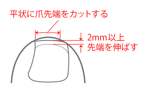 巻き爪クイックケア-準備