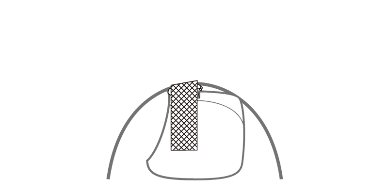 巻き爪クイックケア- ネイルキャップ装着の仕方4