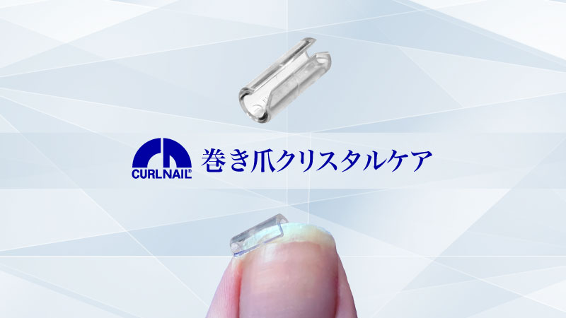 巻き爪矯正自分で治し方